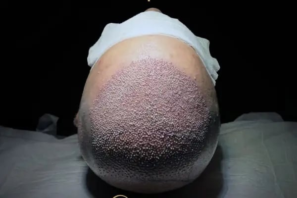 viaTurka İstanbul Medical Aesthetics, Dental &amp; Hair Transplant - Resim 9