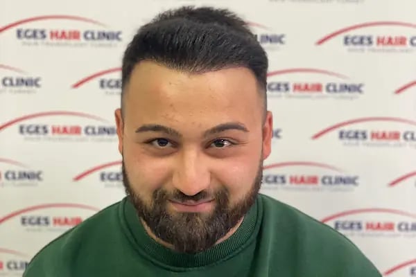 İzmir Saç Ekim Merkezi | Eges Hair Clinic - Resim 4