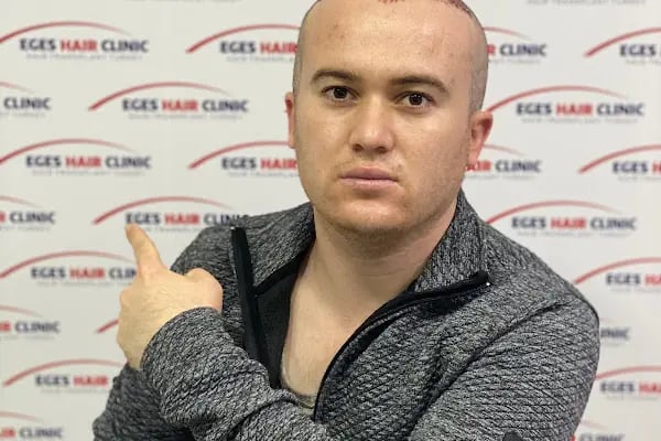 İzmir Saç Ekim Merkezi | Eges Hair Clinic - Resim 15