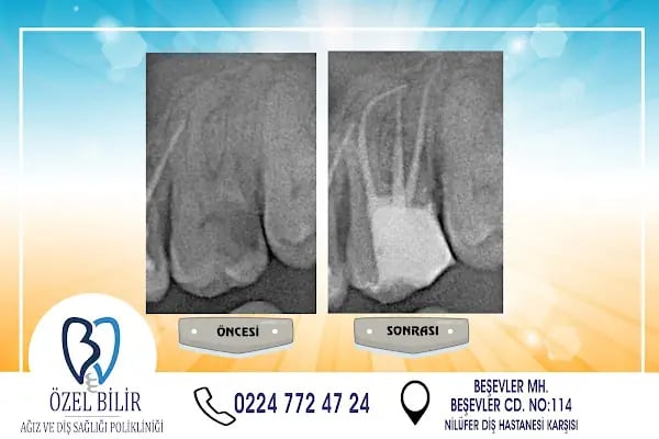 Özel BİLİR Diş Polikliniği - Resim 18