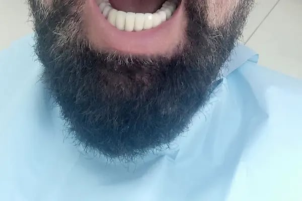 Özel BİLİR Diş Polikliniği - Resim 5