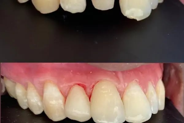 Diş Hekimi Ümmü Topal - Resim 7