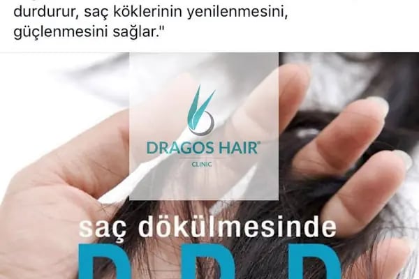 Dragos Hair Saç Ekim Merkezi - Resim 1