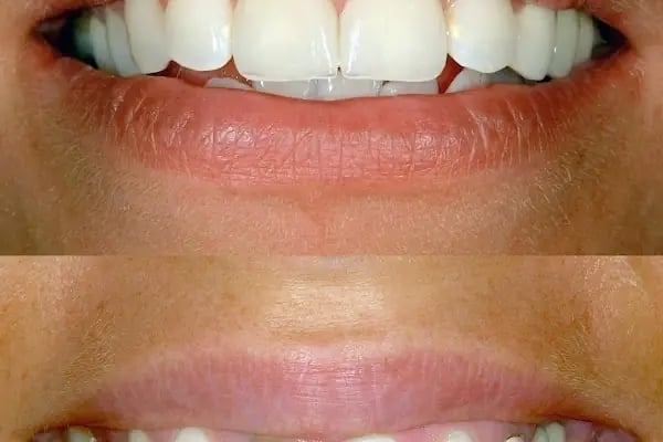 KORUDİŞ Ağız ve Diş Sağlığı Polikliniği - Resim 14