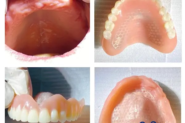 Gönen Özel Dt.Hale Karlıca Diş Kliniği - Resim 14