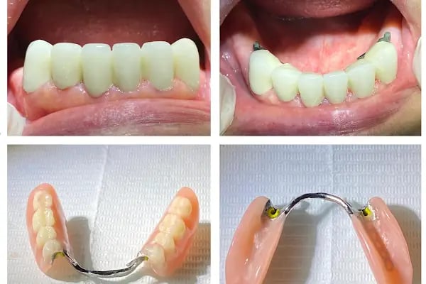 Gönen Özel Dt.Hale Karlıca Diş Kliniği - Resim 9