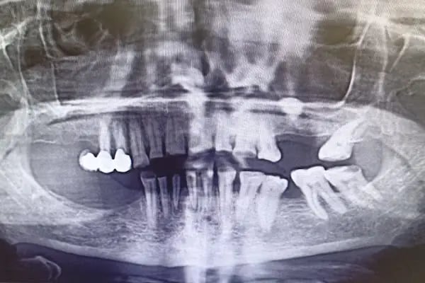 Gönen Özel Dt.Hale Karlıca Diş Kliniği - Resim 6