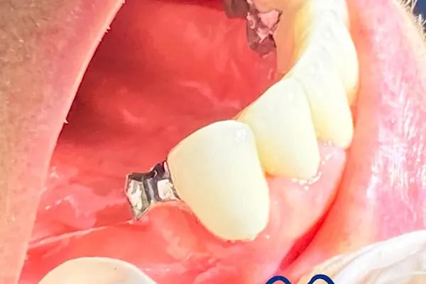 Gönen Özel Dt.Hale Karlıca Diş Kliniği - Resim 13