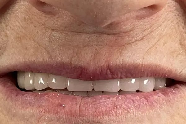 Gönen Özel Dt.Hale Karlıca Diş Kliniği - Resim 16