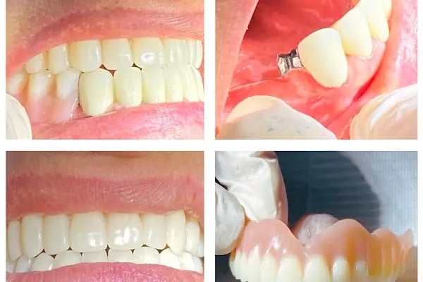 Gönen Özel Dt.Hale Karlıca Diş Kliniği - Resim 11