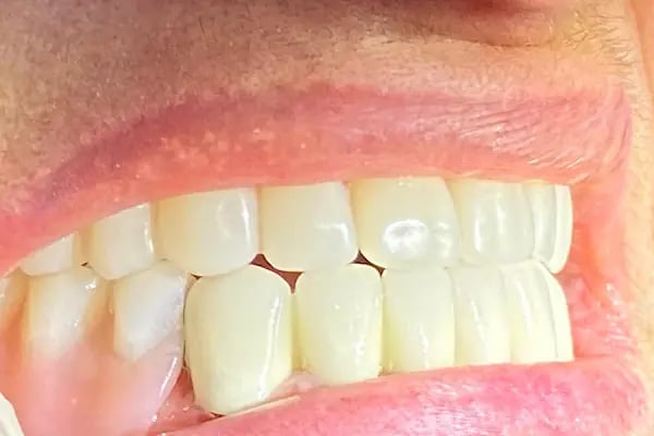 Gönen Özel Dt.Hale Karlıca Diş Kliniği - Resim 15