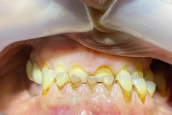 Gönen Özel Dt.Hale Karlıca Diş Kliniği - Resim 3