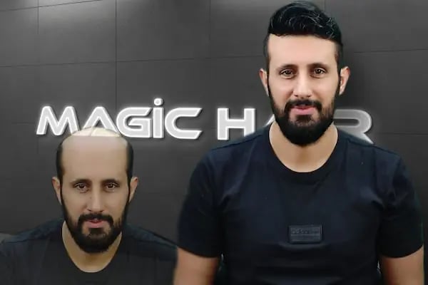Magic Hair Protez Saç Merkezi - Resim 8