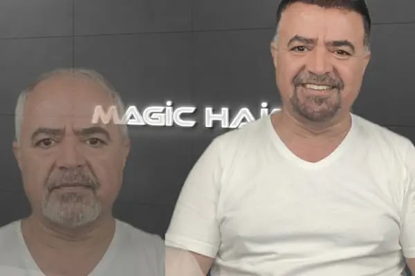 Magic Hair Protez Saç Merkezi - Resim 12