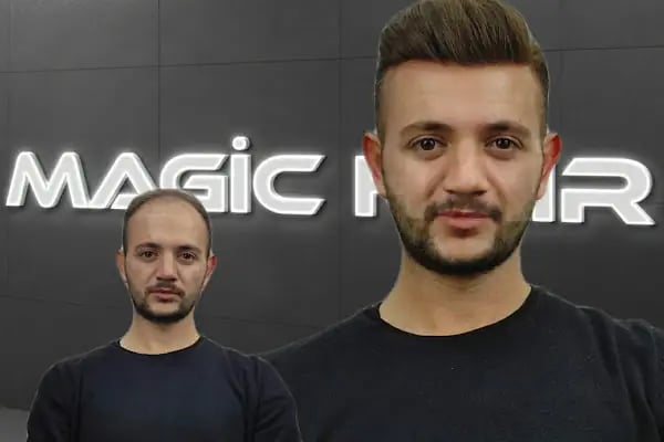 Magic Hair Protez Saç Merkezi - Resim 7