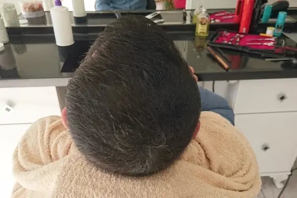Remzi Düğün Salonu - Resim 10