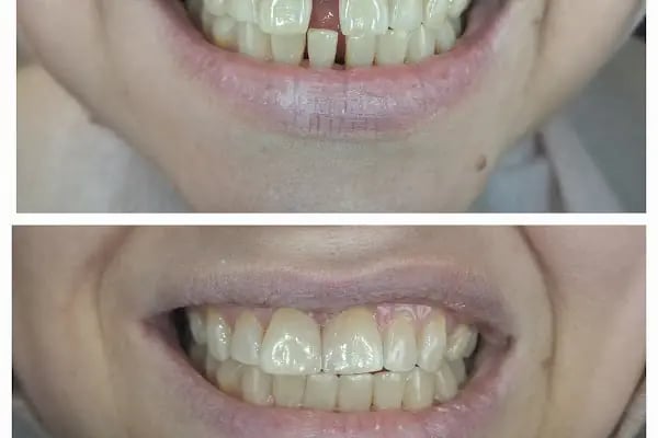 Diş hekimi T. Burak Cerit /Çocuk-Erişkin - Resim 19