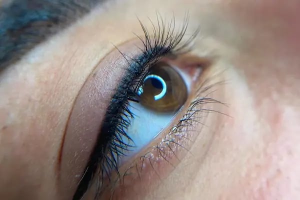 Avrupa Estetik ve Güzellik Merkezi | Soprano Ice Buz Lazer İzmir-Cilt Bakımı-Lazer Epilasyon İzmir-Beauty Center İzmir - Resim 8