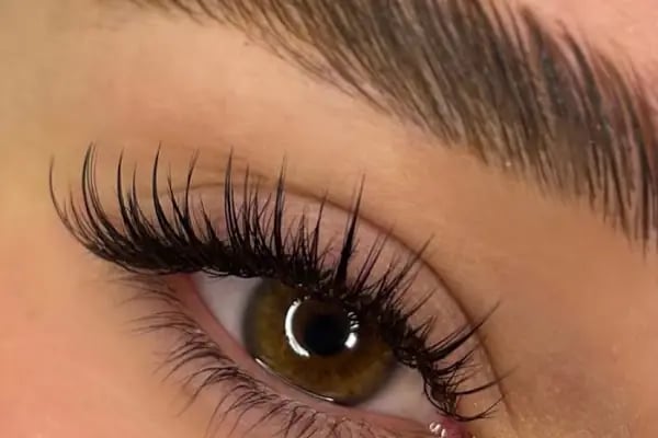 Avrupa Estetik ve Güzellik Merkezi | Soprano Ice Buz Lazer İzmir-Cilt Bakımı-Lazer Epilasyon İzmir-Beauty Center İzmir - Resim 19