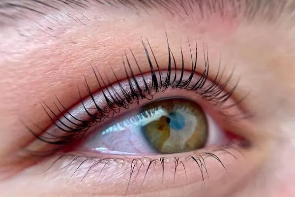 Avrupa Estetik ve Güzellik Merkezi | Soprano Ice Buz Lazer İzmir-Cilt Bakımı-Lazer Epilasyon İzmir-Beauty Center İzmir - Resim 17