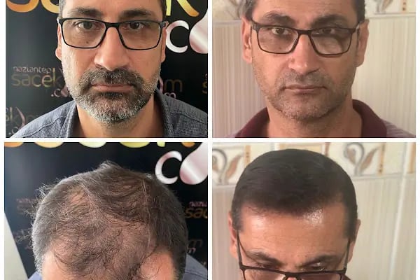 Gaziantep Hair Center(Gaziantep Saç Ekim Merkezi) - Resim 14