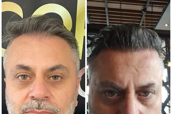 Gaziantep Hair Center(Gaziantep Saç Ekim Merkezi) - Resim 20