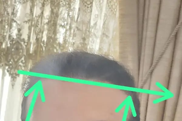 Gaziantep Hair Center(Gaziantep Saç Ekim Merkezi) - Resim 5