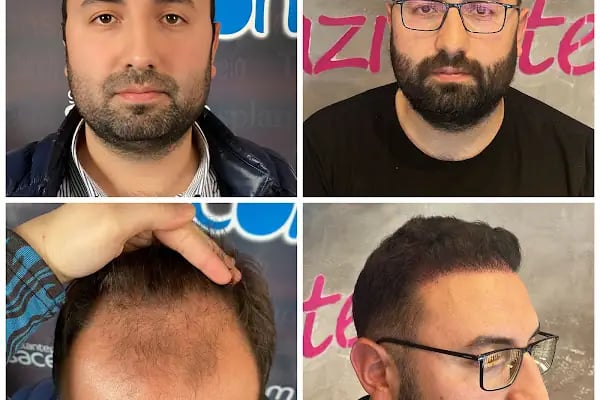 Gaziantep Hair Center(Gaziantep Saç Ekim Merkezi) - Resim 15