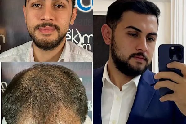Gaziantep Hair Center(Gaziantep Saç Ekim Merkezi) - Resim 9