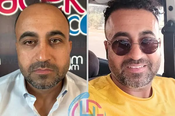 Gaziantep Hair Center(Gaziantep Saç Ekim Merkezi) - Resim 17