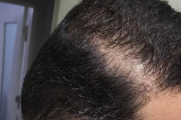 Gaziantep Hair Center(Gaziantep Saç Ekim Merkezi) - Resim 4