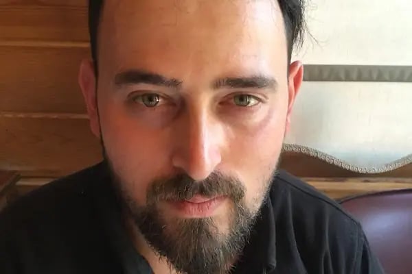 Trabzon Hair Transplant Center I مركز طرابزون لزراعة الشعر - Resim 8
