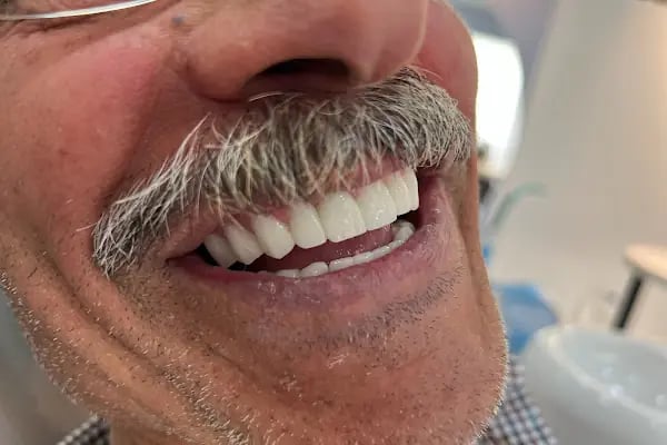 Döşemealtı Ağız ve Diş Sağlığı Polikliniği - Resim 5