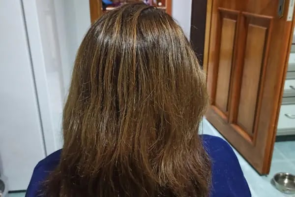 BEYAZ HAIR CLUB - Resim 19