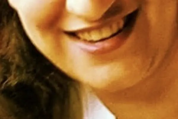 Burun Estetiği (Rinoplasti) Ankara Fiyatları - Op. Dr. Eda Çabuk Horoz, Kepçe Kulak, Göz Kapağı, Gamze Estetiği - Resim 12