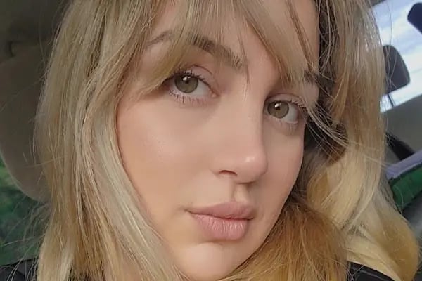 Burun Estetiği (Rinoplasti) Ankara Fiyatları - Op. Dr. Eda Çabuk Horoz, Kepçe Kulak, Göz Kapağı, Gamze Estetiği - Resim 4