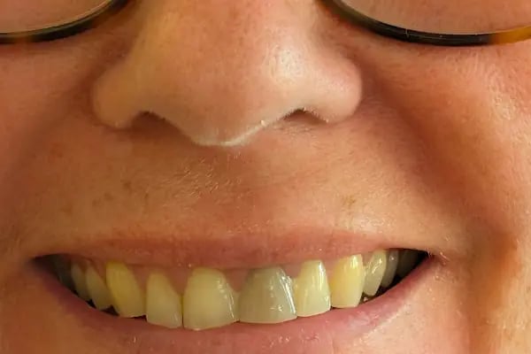 C&amp;G Dental Ağız ve Diş Sağlığı Polikliniği - Resim 11