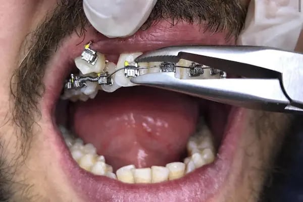 Asudent Ağız ve Diş Sağlığı Polikliniği - Resim 19