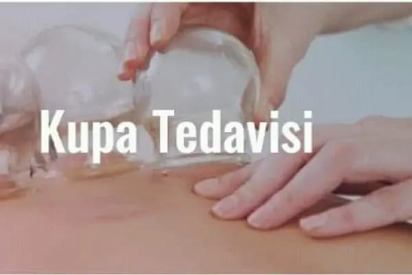 Bursa Gürsu Hacamat Yd - Resim 6