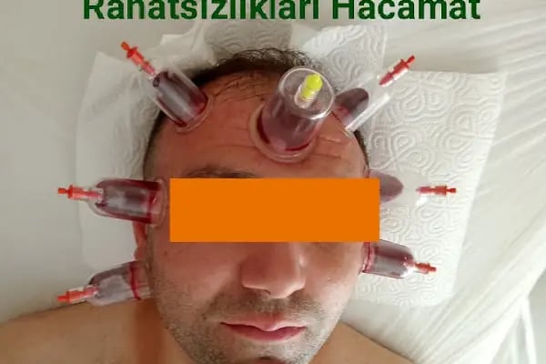 Bursa Gürsu Hacamat Yd - Resim 8
