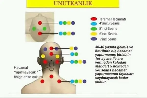 Bursa Gürsu Hacamat Yd - Resim 17