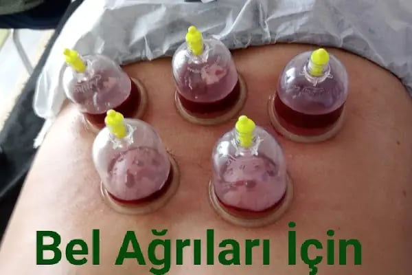 Bursa Gürsu Hacamat Yd - Resim 9