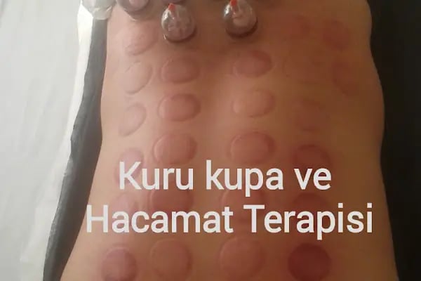 Bursa Gürsu Hacamat Yd - Resim 13