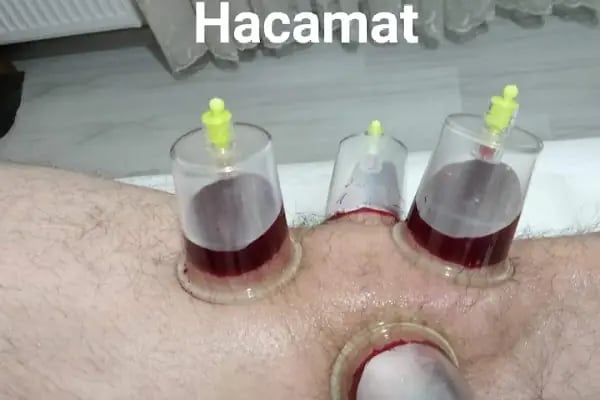 Bursa Gürsu Hacamat Yd - Resim 10