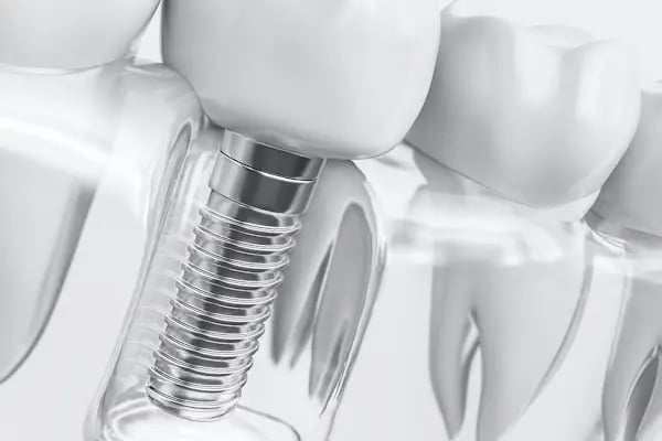 Prof. Dr. Nilgün &amp; Bora ÖZTÜRK - Dental Hayat Ağız ve Diş Sağlığı Polikliniği - Resim 11