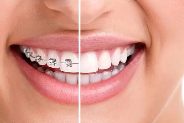 Özel Dent Balgat Ağız Ve Diş Sağlığı Polikliniği - Resim 2