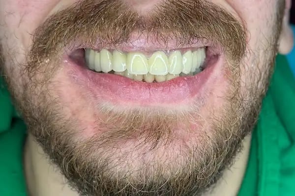 Özel Dent Balgat Ağız Ve Diş Sağlığı Polikliniği - Resim 11