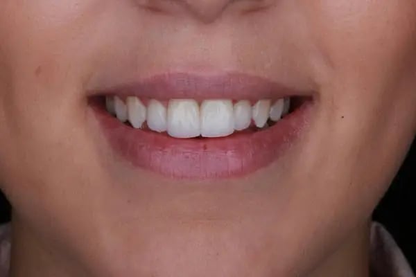 Dentales - Dt. Sözmen Menemencioğlu - Resim 7
