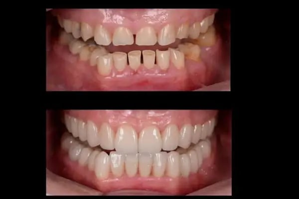 Dentales - Dt. Sözmen Menemencioğlu - Resim 6
