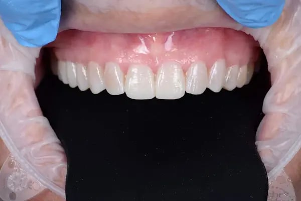 Dentales - Dt. Sözmen Menemencioğlu - Resim 5